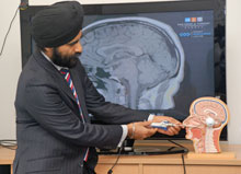 Headaches lead to discovery of tumour - in twin brother